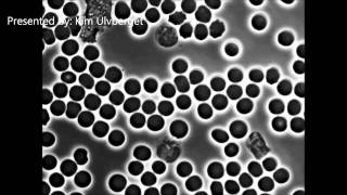 Neutrophil and Tcells in living blood células de la sangre [upl. by Savvas]