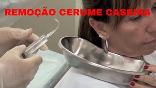 Lavagem ouvido caseira Vídeo Médico Lavar ouvido em casa Remoção cerume caseira [upl. by Assenab]