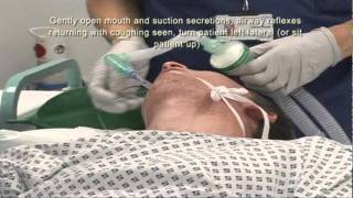 Intubation Extubation 67 [upl. by Bach]