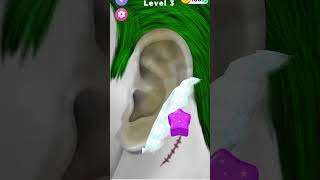 Itchy Smelly Ear Stone Removal Digging Out Super Big Earwax shorts gaming asmr [upl. by Auhsohey591]