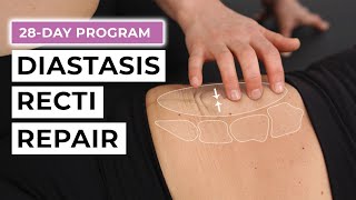 28Day Diastasis Recti Repair Program FREE Challenge [upl. by Laikeze569]