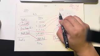 How to deal with positive and negative sign in income statements in defined benefit plan [upl. by Neona]