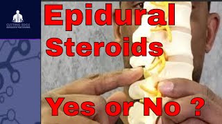 10 Must knows for Epidural steroid injections [upl. by Imnubulo]