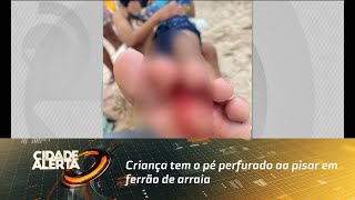 Perigo à beira mar Criança tem o pé perfurado ao pisar em ferrão de arraia [upl. by Olshausen]