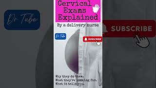 What do the Cervical Exam Numbers Mean pregnancy cervical pain [upl. by Ardnad]