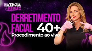 Derretimento Facial  Procedimento Ao Vivo [upl. by Madra]