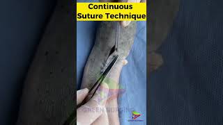 Continuous Suture Technique sutures surgery surgicalsuture [upl. by Jorge107]