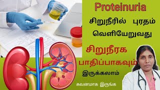 சிறுநீரில் புரதம் போவதால் காணப்படும் அறிகுறிகள் Proteinuria causes and symptoms [upl. by Tyler361]