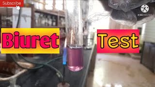 Biuret test  Confirmative Tests for Urea [upl. by Annail10]