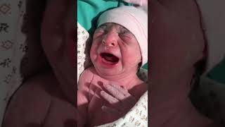 New born baby 😍 first crying 🥰 after birth 🥰newviralvideosubscribe shorts youtubeshorts 😘😍🥰❤️ [upl. by Mutat]