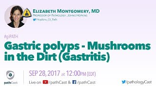 Gastric polyps  Mushrooms in the dirt GASTRITIS [upl. by Ayardna]