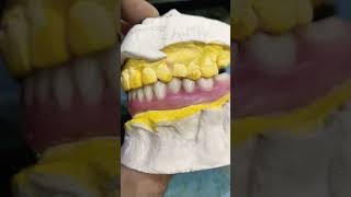 Lower Flexible Denture By Haider 😁😁😁 [upl. by Gnaw688]