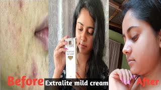 xtralite mild cream Dark spot remover cream  Dailyvlogerpriyanka [upl. by Lahsram769]