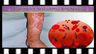 Medical Coding Training — Difference Between Septicemia SIRS and Sepsis [upl. by Delora]