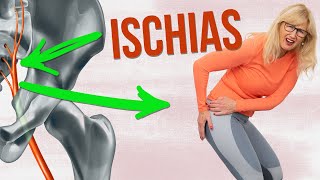 Ischias Übungen ✅ Meine 2 besten Übungen bei Ischias Schmerzen [upl. by Annoyi213]