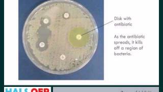 Microbiology resources  How to Measure Zones of Inhibition ZOI [upl. by Carolina597]