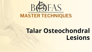 Talar Osteochondral Lesions  BOFAS Master Techniques [upl. by Eugenides]