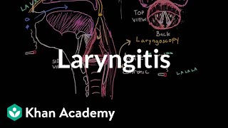 Laryngitis diagnosis treatment and prevention  NCLEXRN  Khan Academy [upl. by Ahcorb]