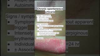 Chronic spontaneous urticaria [upl. by Shell262]