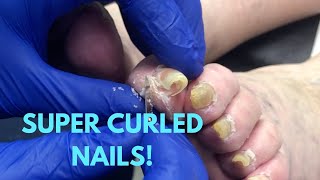 SUPER CURLED NAIL CARE [upl. by Asillim226]