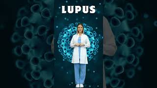 Systemic Lupus Erythematosus SLE Explained What You Need to Know lupus [upl. by Cired]