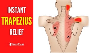 How to Relieve Trapezius Pain FOR GOOD [upl. by Hinman73]