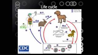 Toxocariasis [upl. by Nitreb]