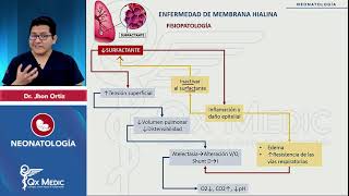 NEONATOLOGÍA  PROBLEMAS RESPIRATORIOS  2024 QX MEDIC [upl. by Seana]