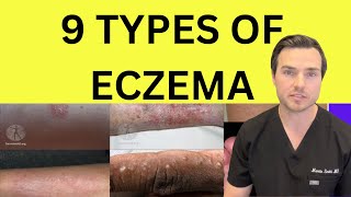 All 9 types of Eczema explained by Dr Martin Smith [upl. by Attenreb]