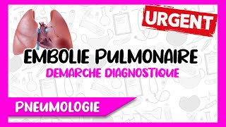 Embolie Pulmonaire Facteurs de Risque Symptômes Diagnostic Positif et Différentiel [upl. by Odraude]