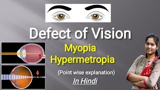 Defects of Vision  Myopia  Hypermetropia  Presbyopia  In Hindi [upl. by Layol]