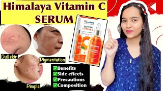 Himalaya Vitamin C Serum की सम्पूर्ण जानकारी  चेहरे के कालेदग़दब्बेpigmentation को दूर करे 🤩✅ [upl. by Porta]