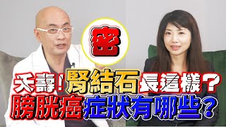 常染髮膀胱癌機率大增？避免長出結石 這招必學！ feat洪士奇醫師｜李曉菁主播 JudyVlog [upl. by Floria]