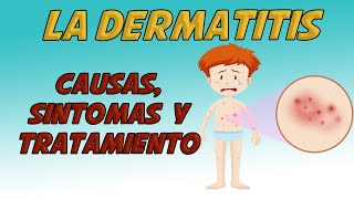 LA DERMATITIS Causas signos y síntomas diagnóstico y tratamiento [upl. by Ingeborg36]