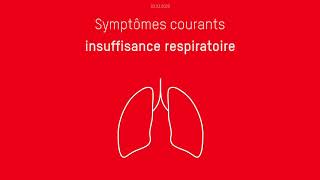 Quels sont les symptômes du Covid19 [upl. by Vail386]