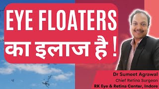 EYE FLOATERS का इलाज है  DO NOT LOSE HOPE  EYE FLOATERS को हटाया जा सकता है [upl. by Dody]