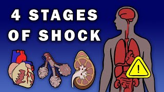 THE 4 STAGES OF SHOCK [upl. by Yeta]