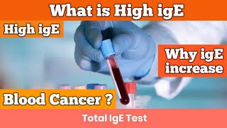 IgE  high ige levels in blood  ige level high treatment  high ige  how to cure ige allergy  ige [upl. by Pradeep]