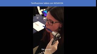 Trattamento tonificazione labbra con NOVAFON pro  Testine Intraorale [upl. by Esidnac]