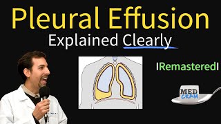 Pleural Effusions  Causes Diagnosis Symptoms Treatment [upl. by Nilcaj431]