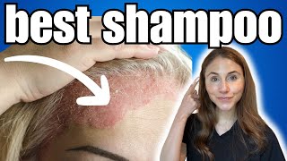 BEST Shampoo For Psoriasis  Dermatologist Recommended [upl. by El827]