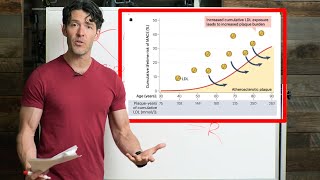 A New LDLCholesterol Theory Coming to a Doctor Near You [upl. by Assiroc]