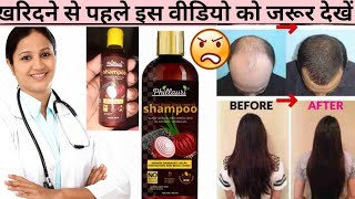 PHILLAURI ONION SHAMPOO TO STOP HAIRFALL REVIEW  PHILLAURI BLACK SEED ONION SHAMPOO FOR HAIR GROWTH [upl. by Annayram]