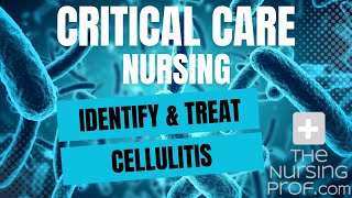 Critical Care Nursing Identify and Treat Cellulitis [upl. by Nyl]