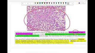 Intro to pathology cell injury lab 3 intracellular accumulations [upl. by Rozek]