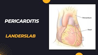 Pericarditis [upl. by Moon]