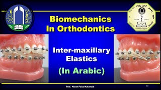 Intermaxillary Elastics in Orthodontics In Arabic [upl. by Llehsar136]