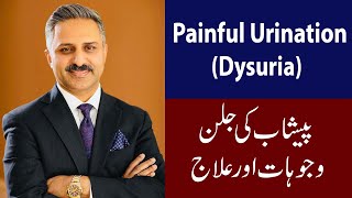 Painful Urination  Dysuria  Causes and Treatment [upl. by Oam]