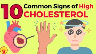 10 Common Signs of High CHOLESTEROL You SHOULD NOT Ignore  VisitJoy [upl. by Aicxela]