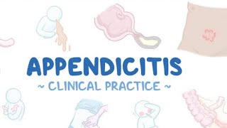 Appendicitis sign symptoms Treatment Homeopathic world [upl. by Assyla]